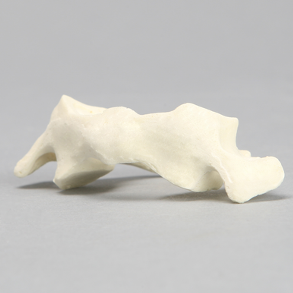 Vertebra, C1, Solid Foam