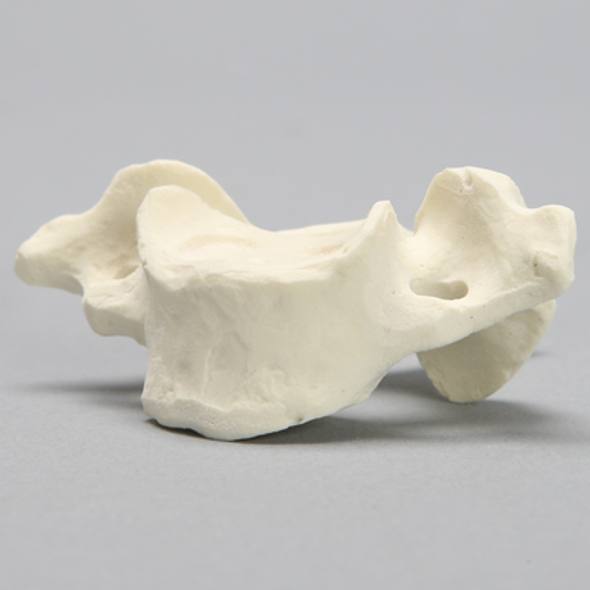 Vertebra, C7, Foam Cortical