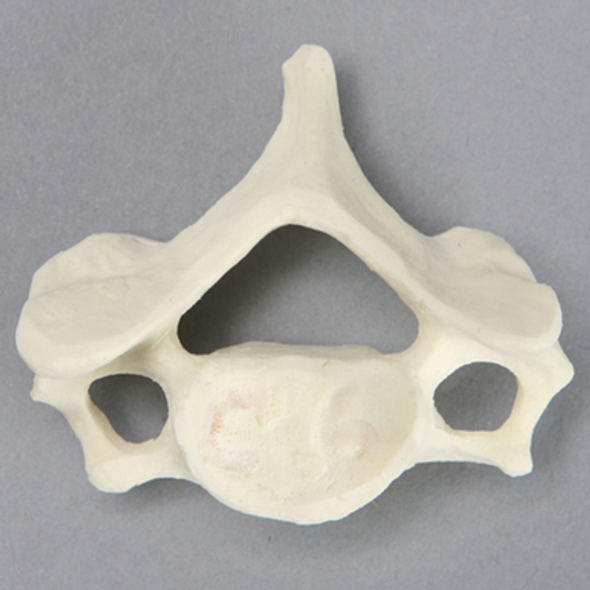 Vertebra, C6, Foam Cortical
