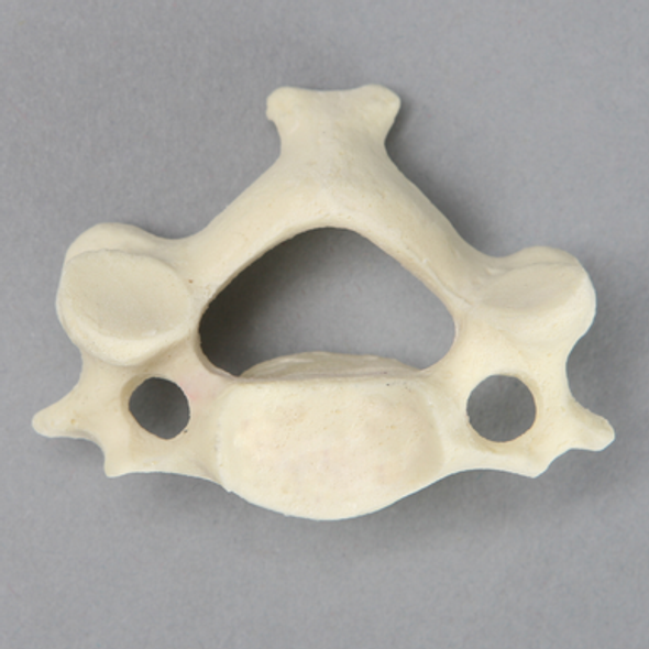 Vertebra, C3, Foam Cortical