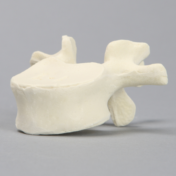 Vertebra, L1, Solid Foam
