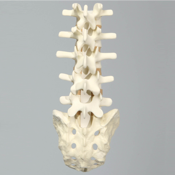 Spine, Lumbar with Flat Back Pathology, Foam Cortical