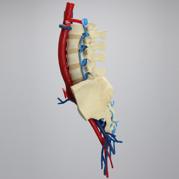 Spine, Lumbar, Iliac Crests with Aorta, Vena Cava, and Nerve Roots, Foam Cortical