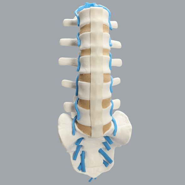 Spine, Lumbar with Blue Nerve Roots, Foam Cortical