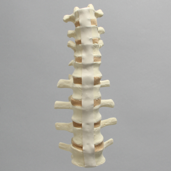 Spine, T9-L4, Foam Cortical