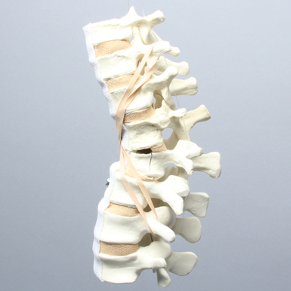 Spine, T9-L4, with L1 Burst, Foam Cortical