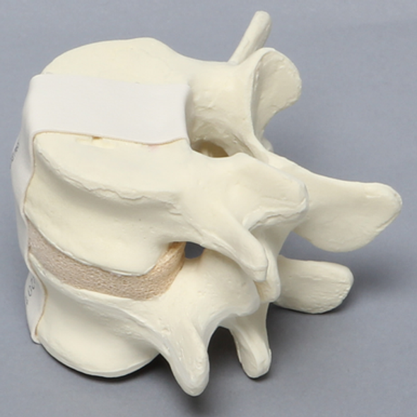 Lumbar Vertebrae, L4-L5, Foam Cortical