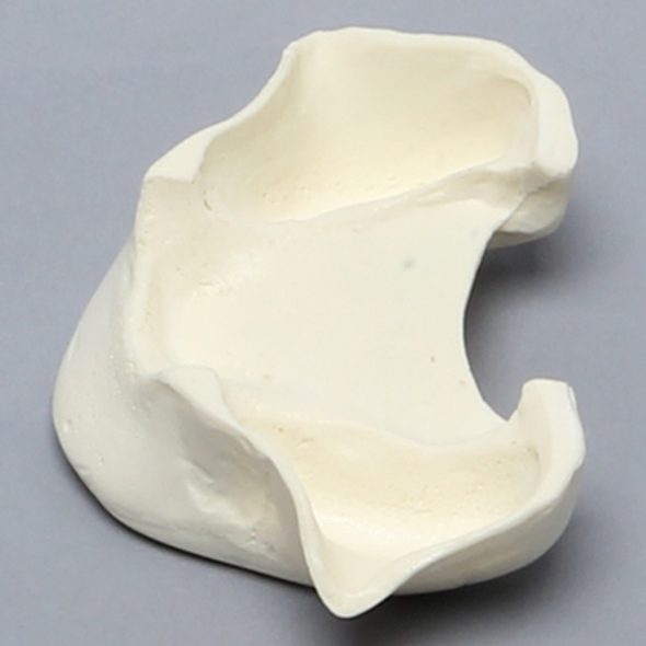 Maxilla, Edentulous