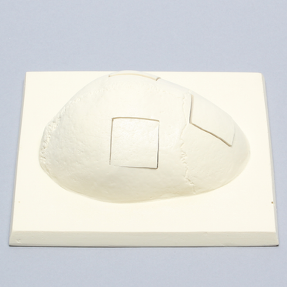 Skull Cap with Three Craniotomies