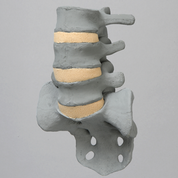 Spine, Lumbar, L3-Sacrum, Radiopaque