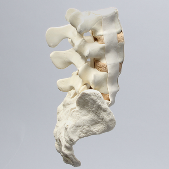 Spine, Lumbar with Bilateral Ligaments, L3-Sacrum, Solid Foam