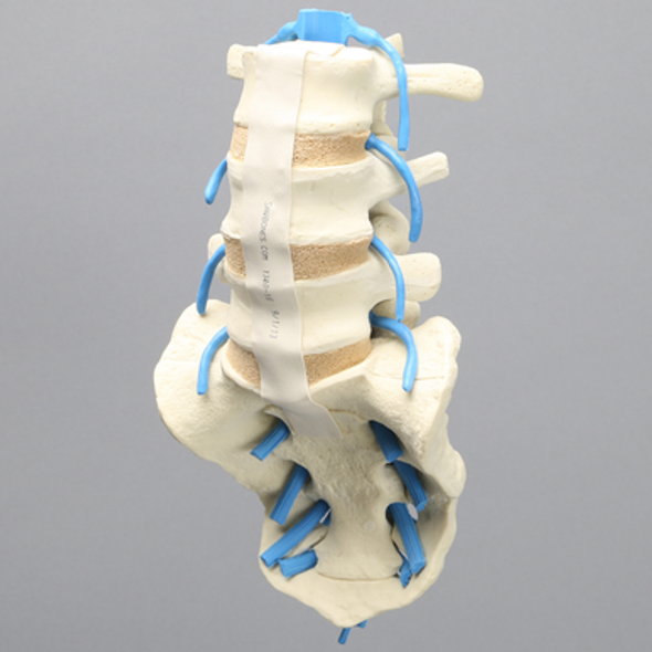 Spine, Lumbar with Nerve Roots, L3-Sacrum, Foam Cortical