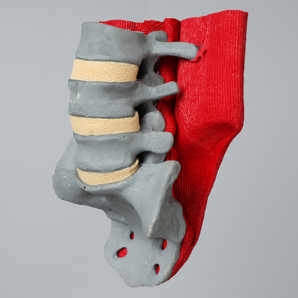 Spine, Lumbar with Muscles, L3-Sacrum, Radiopaque
