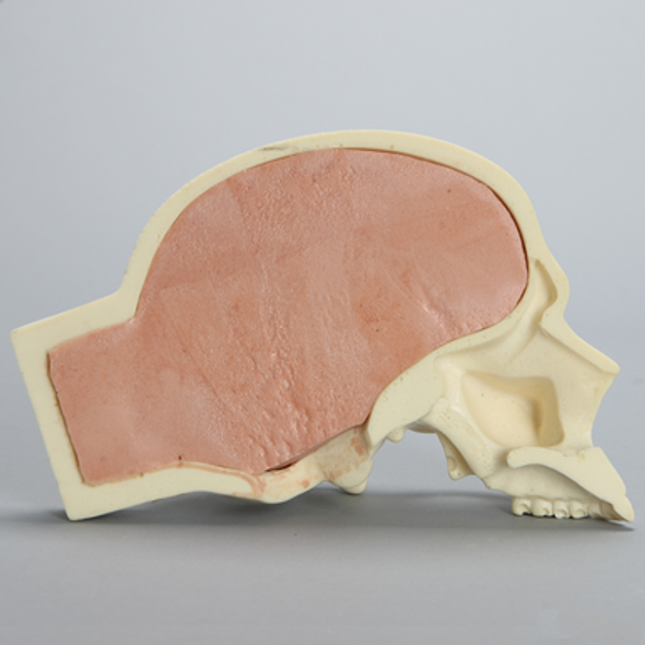 Partial Skull with Brain for Craniotomies