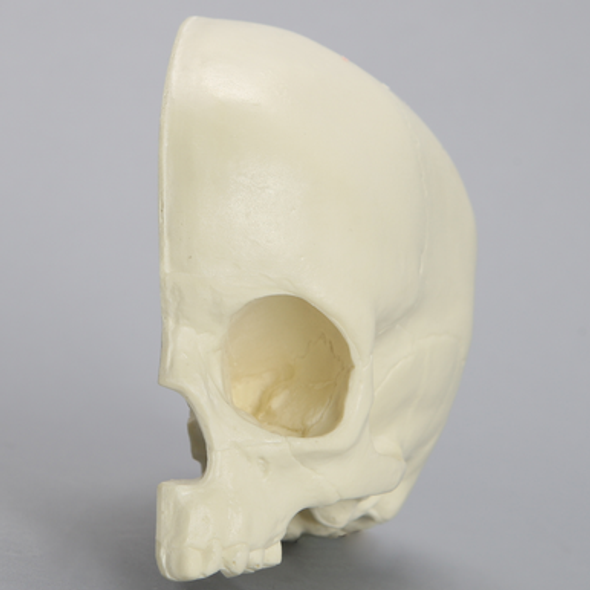 Skull, Left Partial Pediatric, with Vise Attachment
