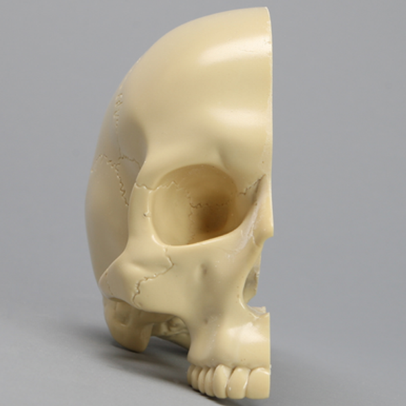 Skull, Right Partial, with Vise Attachment