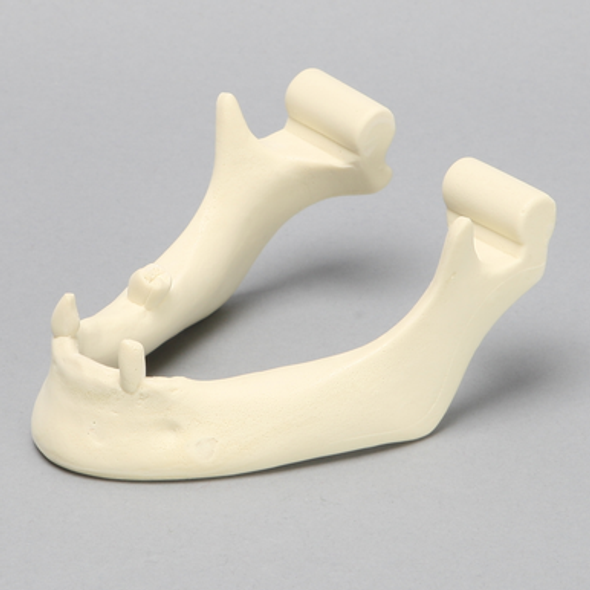 Mandible, Partially Edentulous