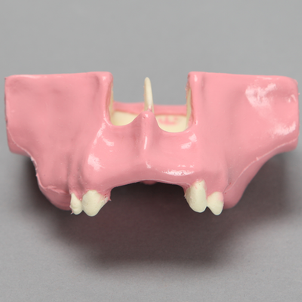Maxilla with Gum Tissue