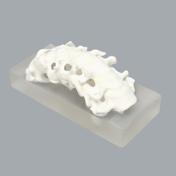 Spine, Cervical, Non-slip Block, Solid Foam
