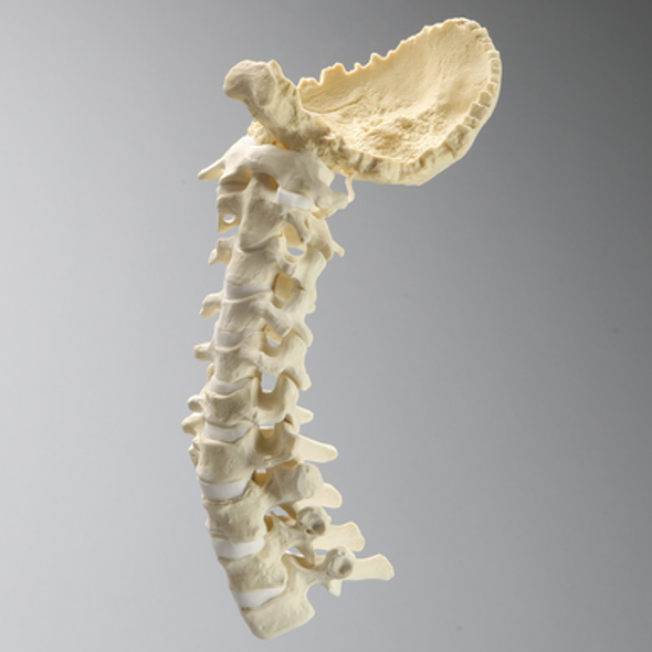 Spine, Occipital-T3, Posterior Ligament and White Discs, Solid Foam