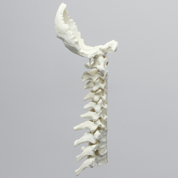 Spine, Occipital-T3, Ligaments and White Discs, Solid Foam