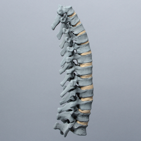 Spine, Thoracic T1-T12, Radiopaque