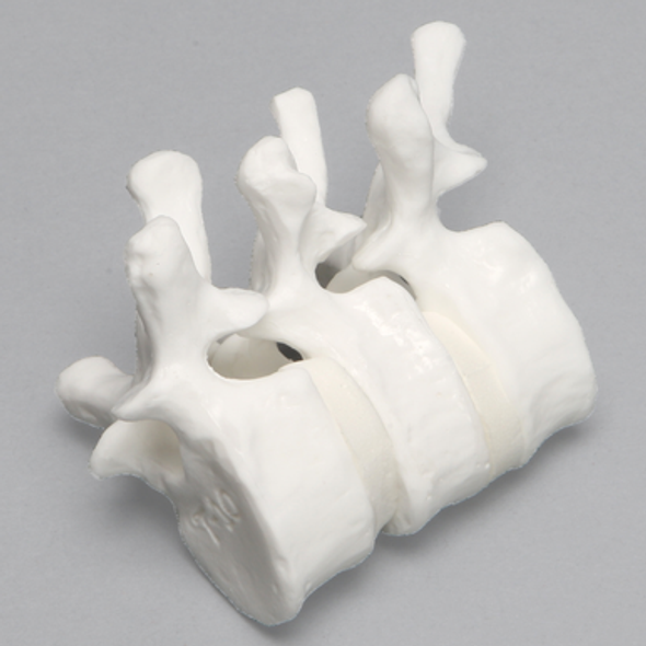 Thoracic Vertebrae, T8-T10, Solid White Plastic