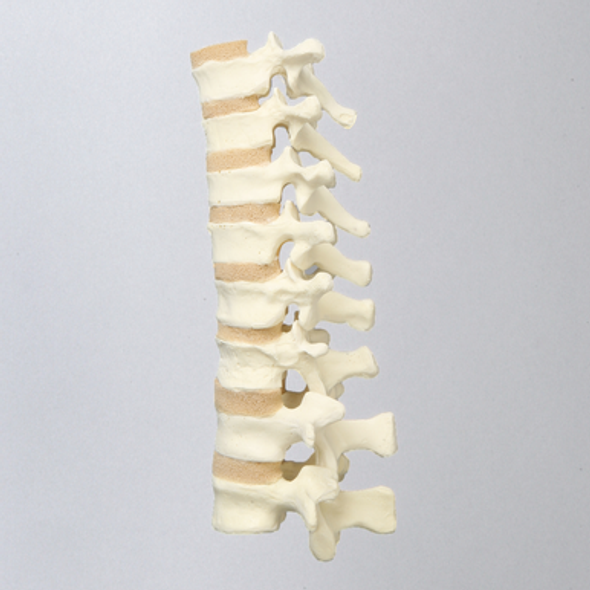 Spine, T7-L2, Solid Foam