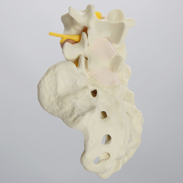 Spine, Lumbar Vertebrae, L4-Sacrum with Nucleus Filled Discs, Solid Foam