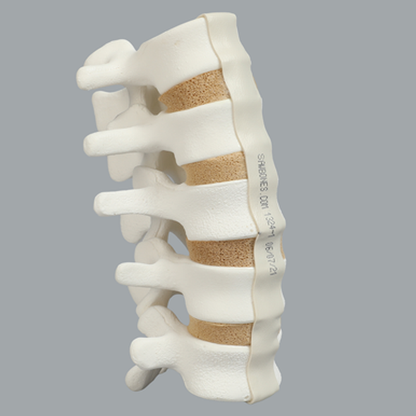 Spine, Lumbar, L1-L5 with Tan Discs, Solid Foam