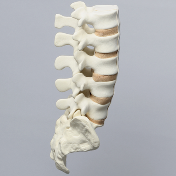 Spine, Lumbar, L1-Sacrum with Tan Discs, Solid Foam