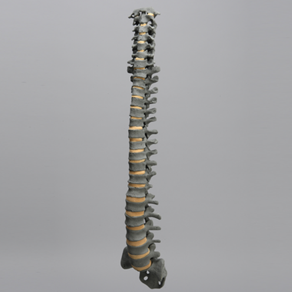 Spine, Full, Foam Cortical Shell, Radiopaque