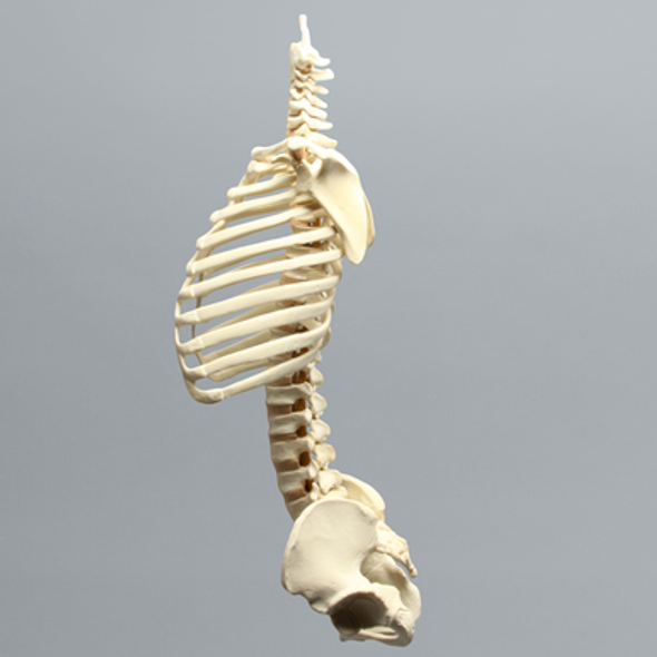 Spine, Torso, Pediatric, Solid Foam