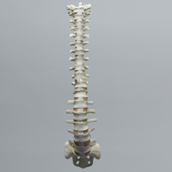Spine, T1-Sacrum with Partial Cancellous, Foam Cortical