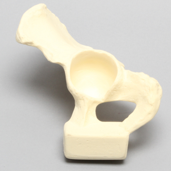 Hemi Pelvis with Global Defect, Male, Solid Foam, Left