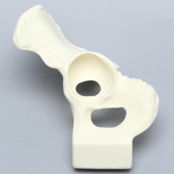 Hemi Pelvis with Global Defect, Solid Foam, Left