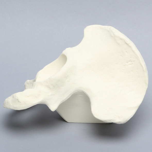Hemi Pelvis with 64 mm Acetabulum, Solid Foam, Left