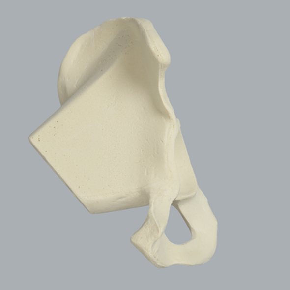 Hemi Pelvis with 56 mm Acetabulum and Vise Attachment, Solid Foam, Left