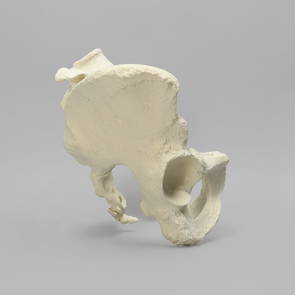 Lumbar Spine with Pelvis, Full Female, Solid Foam