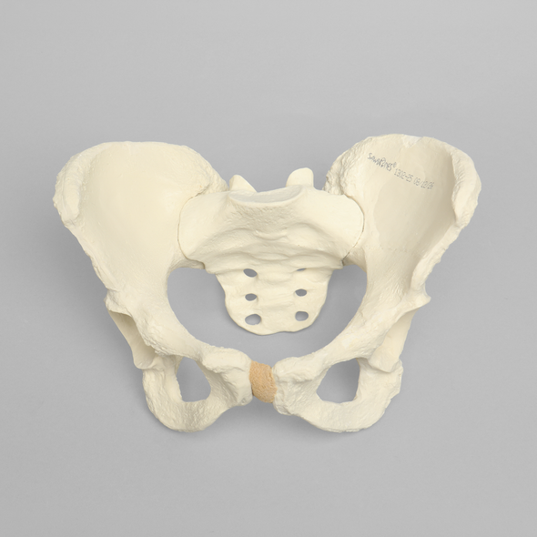 Pelvis with Dysplasia, Full Female, Solid Foam