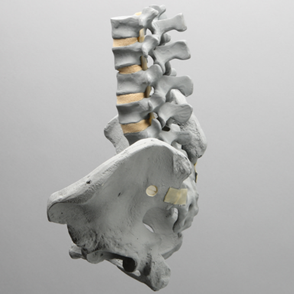 Lumbar Spine with Pelvis, Full Male, Radiopaque