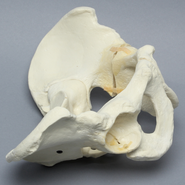 Pelvis with Wall Fractures and Periosteum, Full Male, Foam Cortical