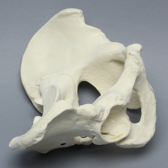 Pelvis with Posterior Wall Fracture, Full Male, Foam Cortical