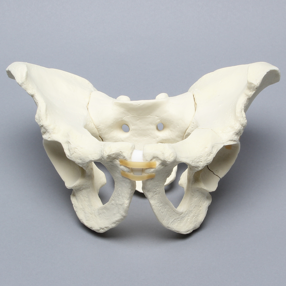 Pelvis with Acetabular Fractures, Full Male, Foam Cortical