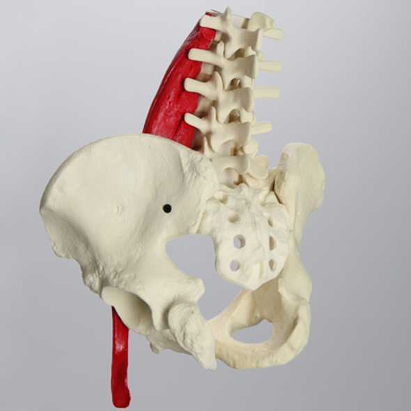Lumbar Spine with Full Pelvis and Psoas Muscle, Solid Foam