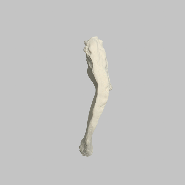 Iliac Crest, Male, Solid Foam, Right