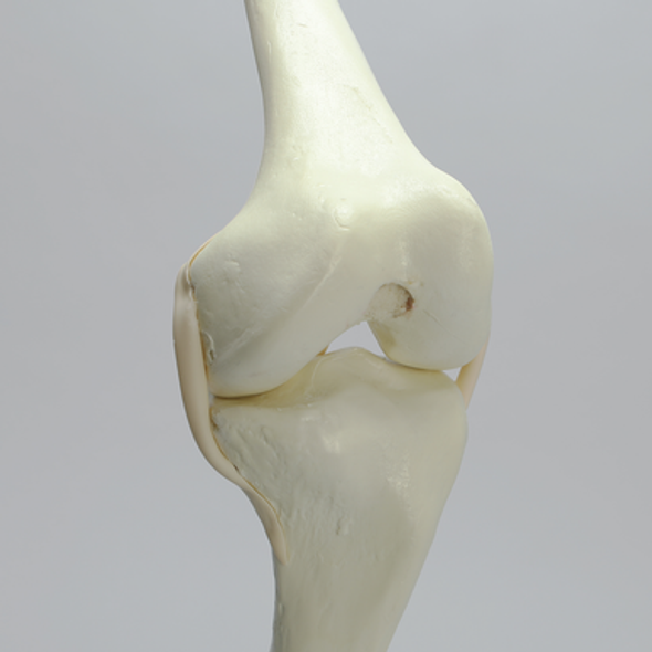 Knee with Average Asian Attributes, Foam Cortical Shell