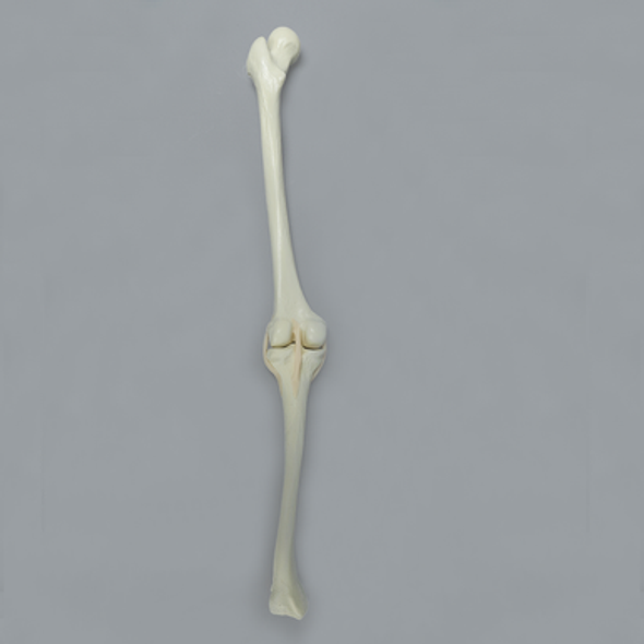 Full Length Knee with Pathologies, Small