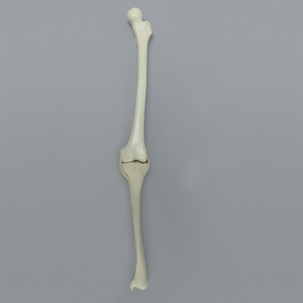 Full Length Knee with Pathologies, Small