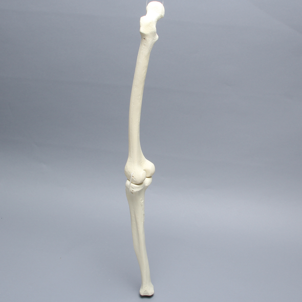 Knee with Two Collateral Ligaments and Narrow Intercondylar Notch, Full Length